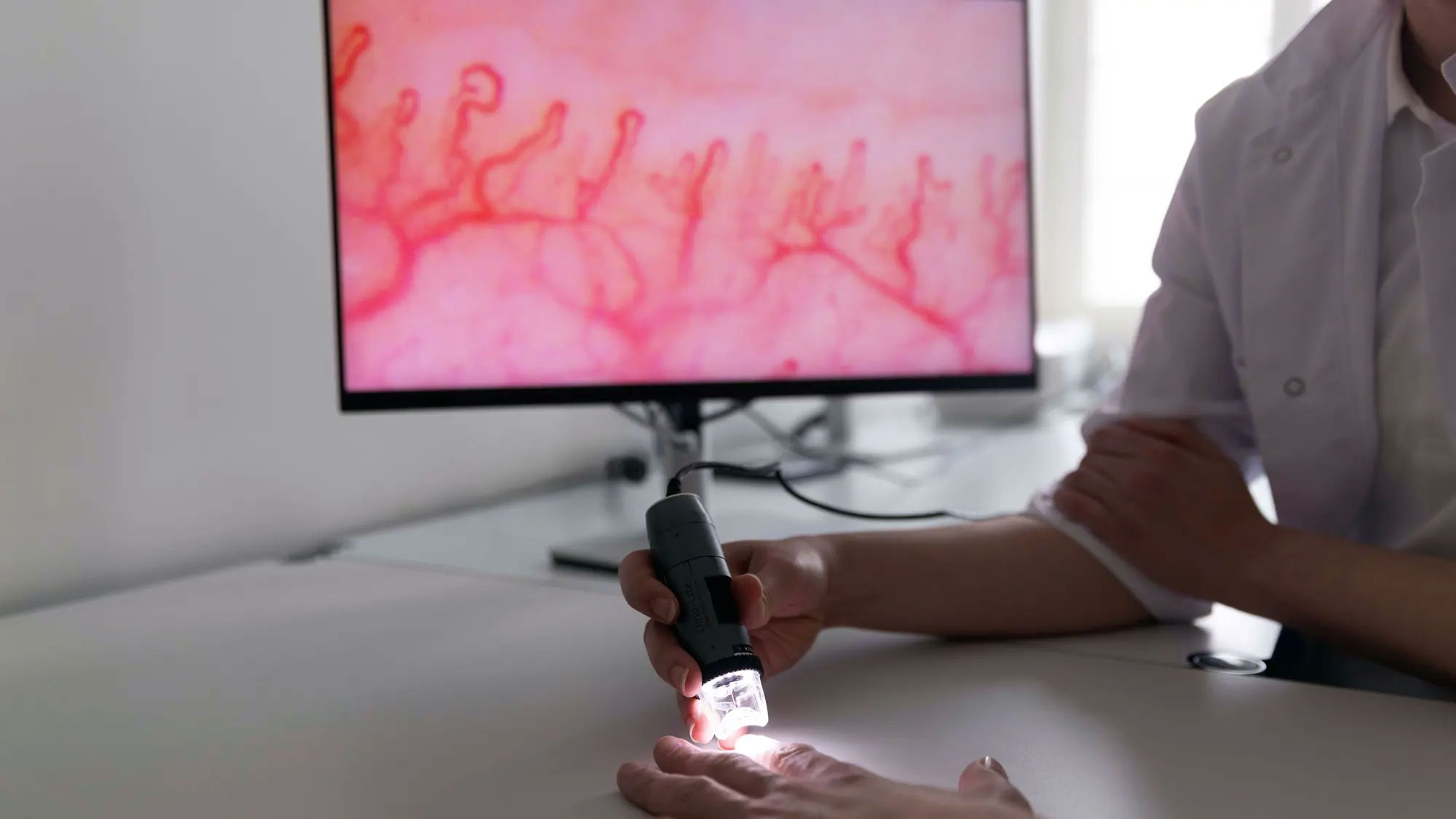 Nailfold capillaroscopy